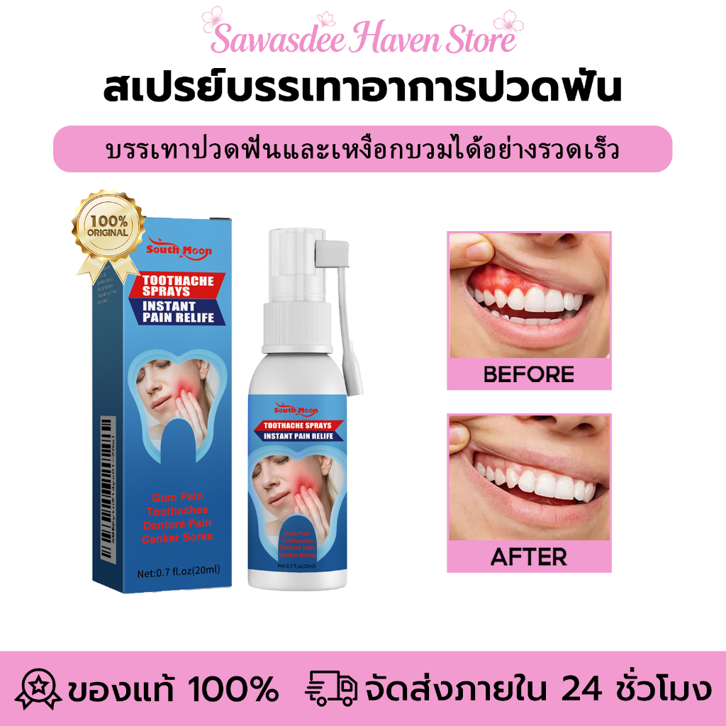 South Moon สเปรย์บรรเทาอาการปวดฟัน บรรเทาอาการปวดฟันได้อย่างรวดเร็ว ทั้งปวดเหงือกและปวดเส้นประสาท