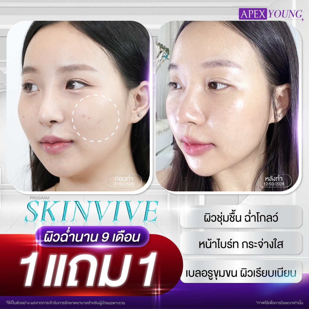 [E-Voucher] APEX โปรแกรม Skinvive 1แถม1 ฟื้นฟูผิวแห้ง เติมความชุ่มชื้น ให้ผิวอิ่มน้ำฉ่ำโกลว์ ราคาพิเศษเท่านั้น – โปรปัง