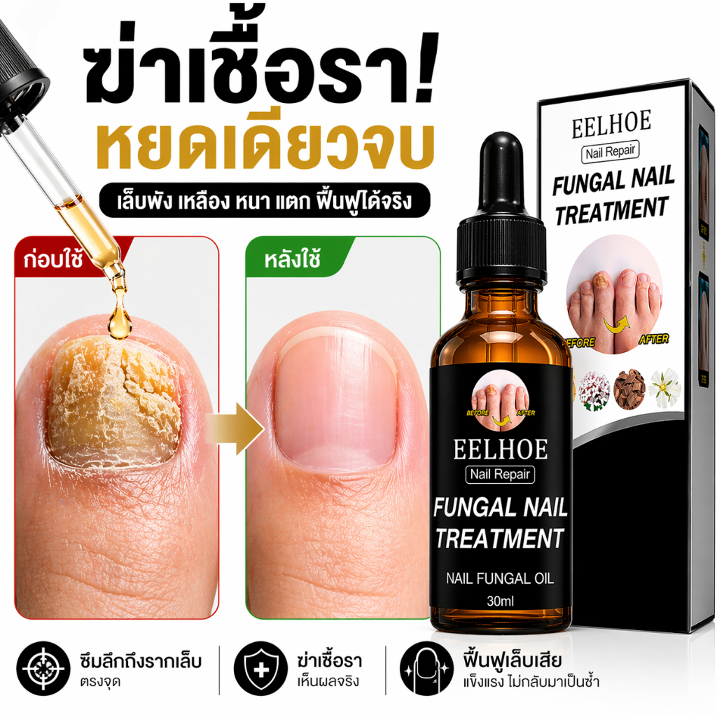 เซรั่มดูแลเล็บ สำหรับเล็บเสีย เล็บหนา เล็บเปลี่ยนสี ฟื้นฟูเล็บ มือและเท้าใช้ได้