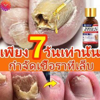 【ผู้ขายในท้องถิ่น】Nail Repair Essenceเซรั่มบำรุงเล็บ ลากับเล็บเสีย ไม่ทำร้ายเล็บดี ห่างกับปัญหาเล็บ30ml