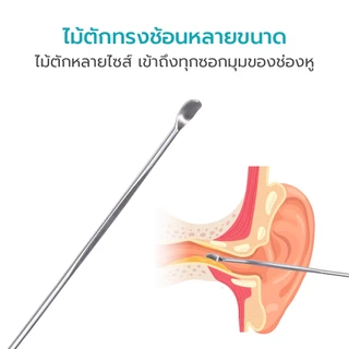 Simple health ชุดแคะหู ที่แคะหู 7ชิ้น อุปกรณ์ทำความสะอาดรูหู ใช้งานง่าย สะดวก ทนทาน Ear picking set