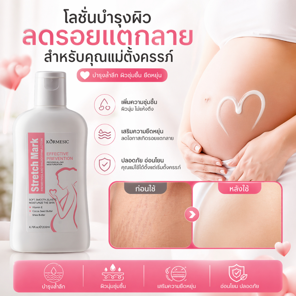 ✨ผิวเรียบเนียน✨ ลดรอยแตกลาย  ครีมลดรอยแตกลาย บำรุงผิว เพิ่มความชุ่มชื้น ลดเลือนรอยแตกลาย ผิวนุ่มยืดหยุ่น ซึมไว อ่อนโยน
