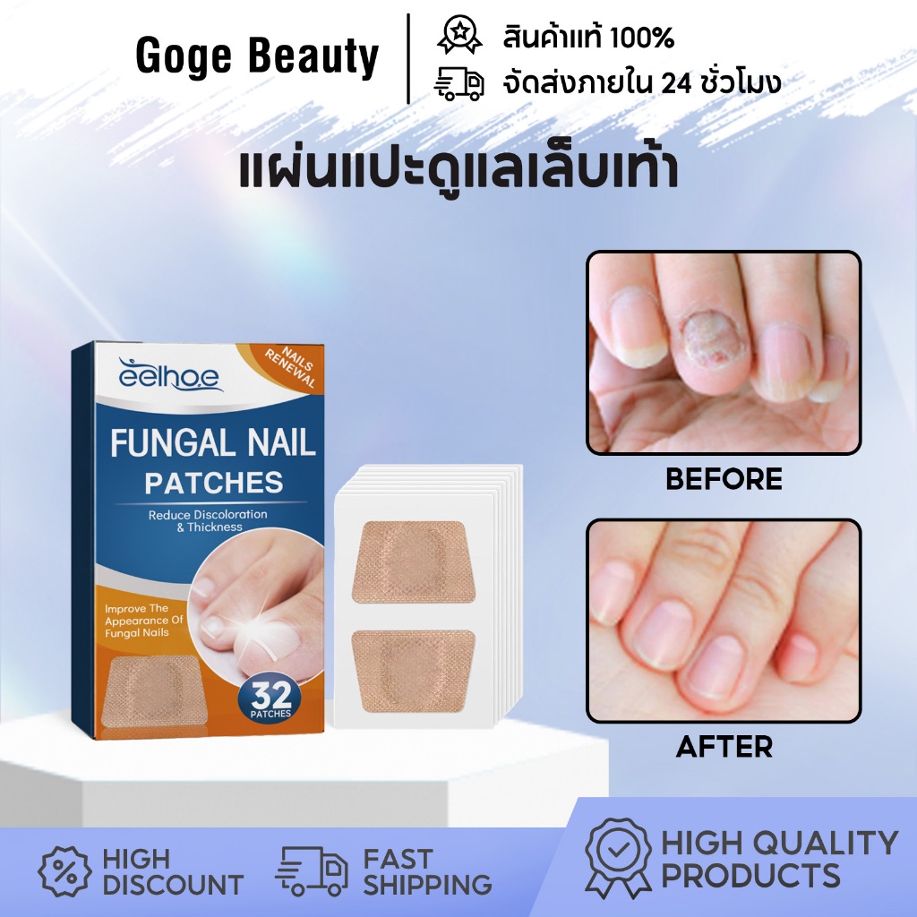 EELHOE แผ่นแปะดูแลเล็บเท้า แผ่นแปะเล็บขบ แผ่นแปะเล็บ สำหรับดูแลเล็บเท้า ซ่อมเล็บ ต้านเชื้อรา 32pcs