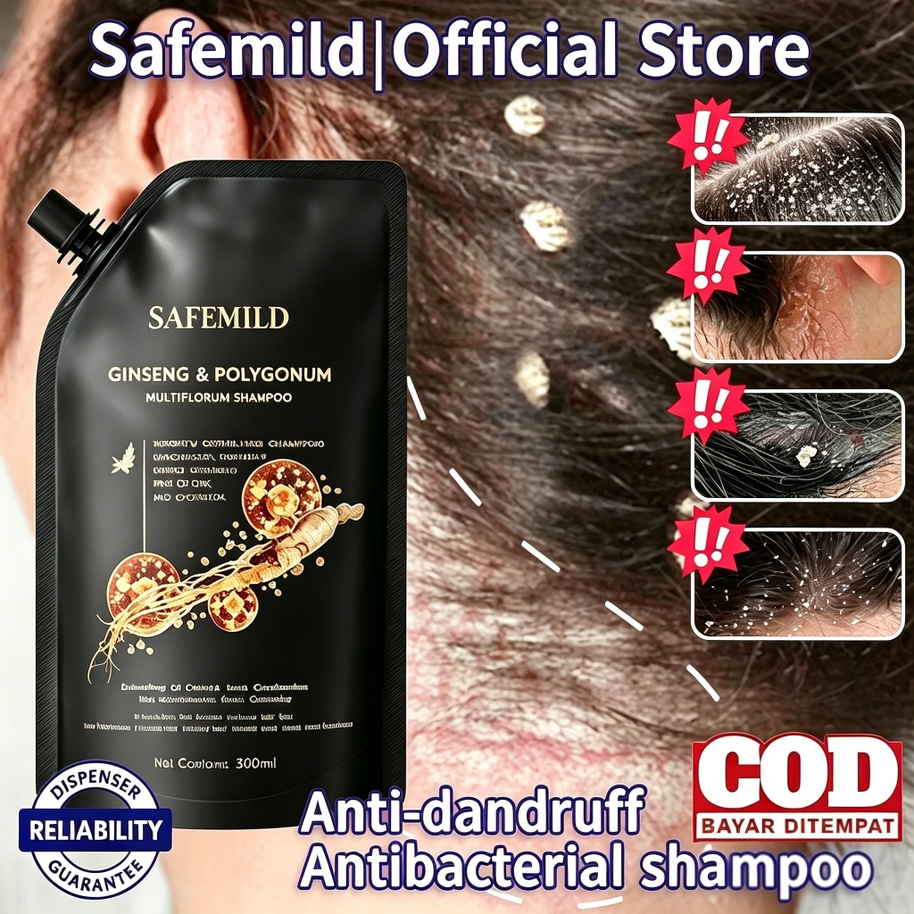 🔥COD🔥SAFEMILDแชมพูรังแคสูตรธรรมชาติ หนังศีรษะสดชื่นทั้งวัน ลดคันหนังศีรษะ เชื้อรา ควบคุมความมัน ลดผมร่วง มีพร้อมส่ง