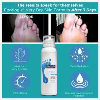Footlogix #3 มูสบำรุงส้นเท้า ครีมทาส้นเท้า สำหรับเท้าแห้งมาก ซึมไว ไม่เหนียว 125ml