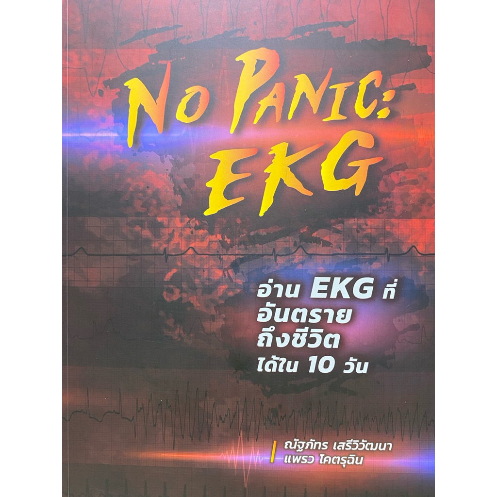NO PANIC : EKG อ่าน EKG ที่อันตรายถึงชีวิตได้ใน 10 วัน