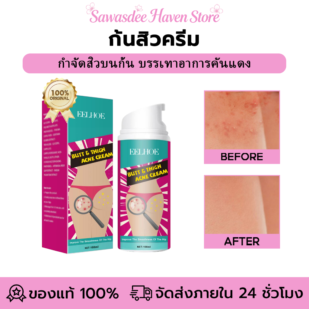 EELHOE ครีมที่ก้น ก้นสิวครีม ครีมทาก้น ครีมทาก้นขาว ลบสะโพกสิว รอยสิ ก้นดำ จบปัญหาก้นดำ ก้นเนียน