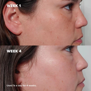 Paula’s Choice Skin Perfecting 2% BHA 118ml ทำความสะอาดรูขุมขนลึก ลดสิวอุดตัน