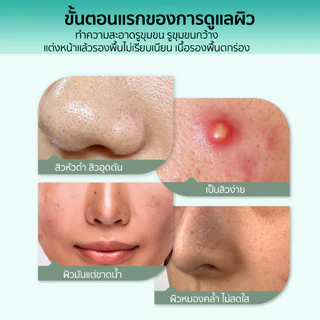 PO³ (PO Cube)มาส์กดูแลสิวเสี้ยนจมูก ช่วยทำความสะอาดรูขุมขน ผิวดูสะอาดสดชื่น
