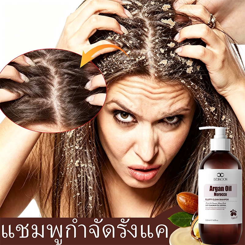 [ขายดี] แชมพูรังแค แชมพูคัน แชมพู 500ml แชมพูแก้คันหนังศรีษะ ขจัดรังแค หยุดอาการคัน [Anti Dandruff Shampoo]