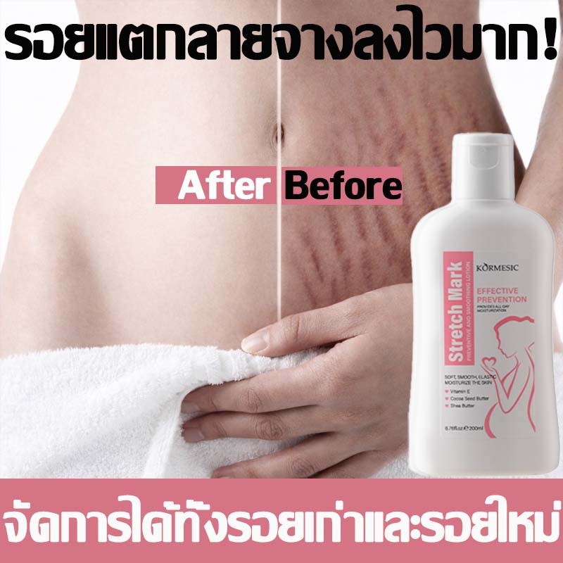 ครีมลดรอยแตก ครีมทาแตกลาย ครีมกันแตก200ml ลดรอยแตกลาย ชุ่มชื้น กระชับผิว ยืดหยุ่น ผิวเรียบเนียน ครีมทารอยแตกขา