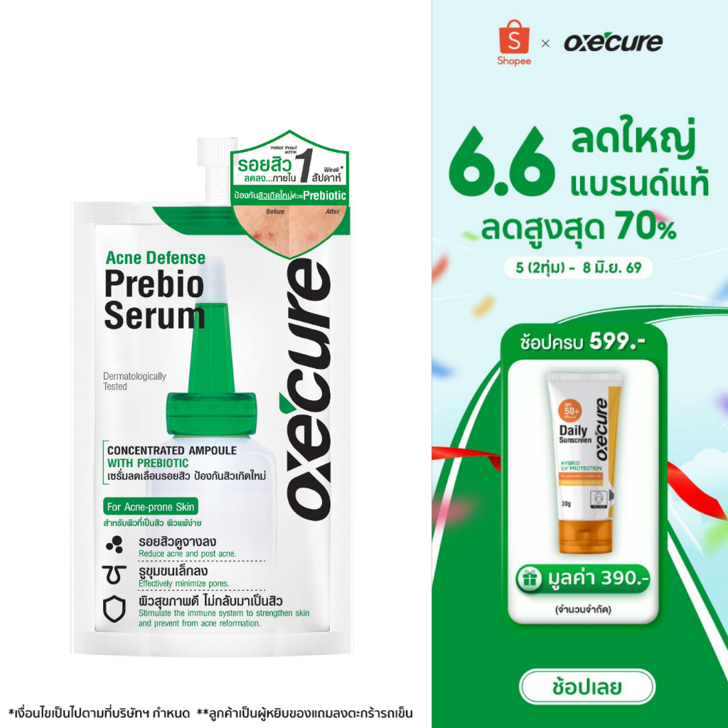 Oxe'cure เซรั่มลดรอยสิว Acne Defense Prebio Serum 5 ml ลดการอักเสบ เพิ่มความชุ่มชื้น 10OX00107