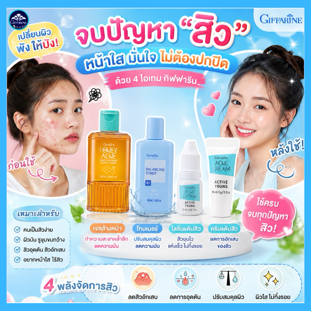 กิฟฟารีนเซ็ตรักษาสิว ผิวหน้าสำหรับวัยรุ่นเหมาะสำหรับทุกสภาพผิวที่มีสิวอักเสบอุดตัน ลดความมันบนใบหน้า