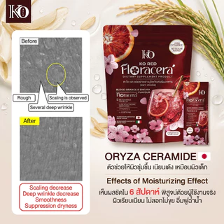 [ ตะกร้าบริษัท ] ฟลอราเซร่า เคโอริช FLORACERA [ เต็มโดส 5 ฟังก์ชั่น] Vitc -ส้มเลือด -ซากุระ -เซลาไมด์ -กลูต้ารีดิ้ว