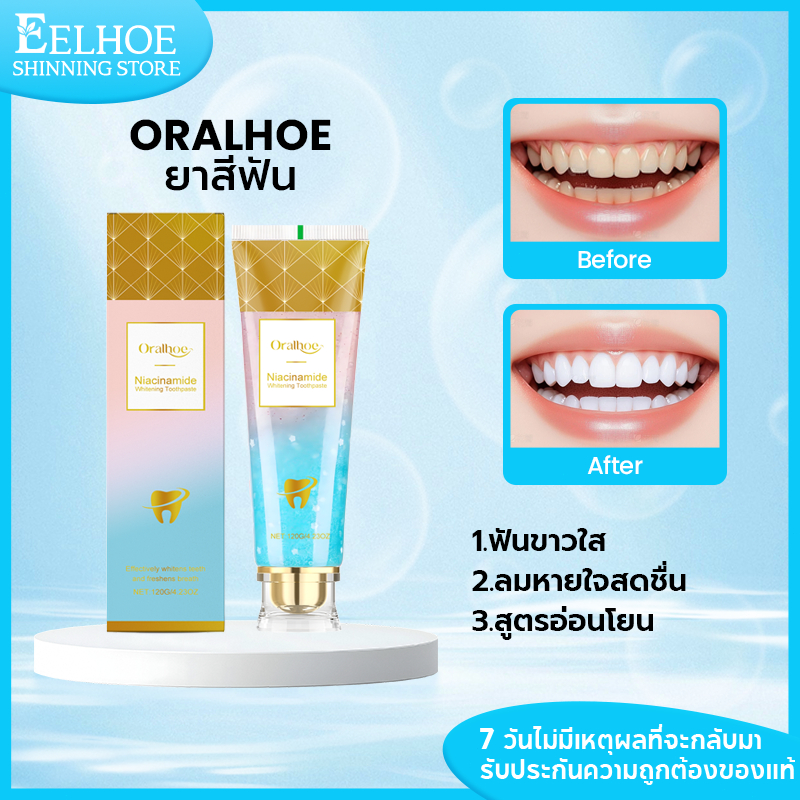 Oralhoe ยาสีฟัน Niacinamide ฟันขาวสดใส ลดกลิ่นปาก ลมหายใจสดชื่น ดูแลฟันทุกวัน