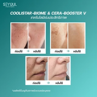 SEYOUL Advanced Serum 50ml เซรั่มลดเลือนฝ้า กระ จุดด่างดำ 10% Niacinamide + Arbutin เติมความชุ่มชื้น