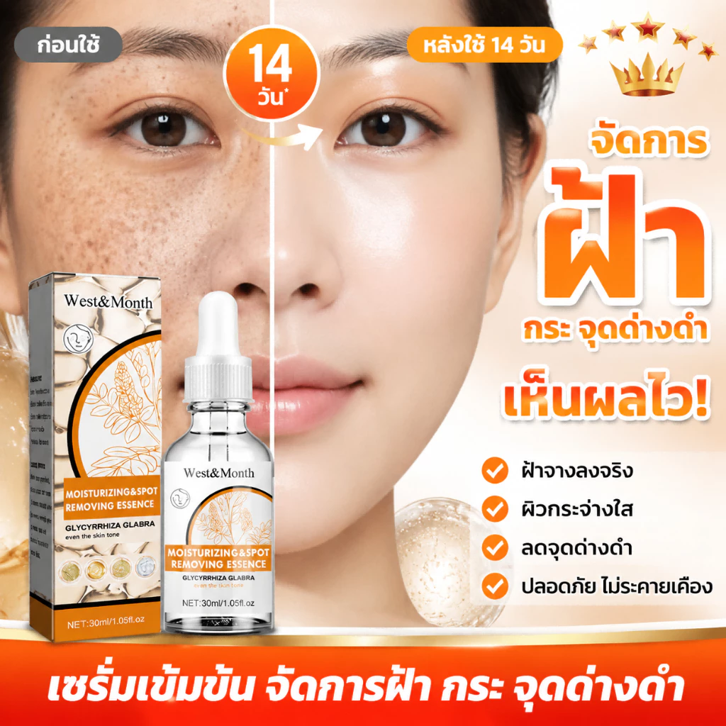 ครีมทาฝ้า 30ml ขจัดฝ้ากระ จุดดำ ผิวหน้าขาวใส