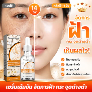 ครีมทาฝ้า 30ml ขจัดฝ้ากระ จุดดำ ผิวหน้าขาวใส