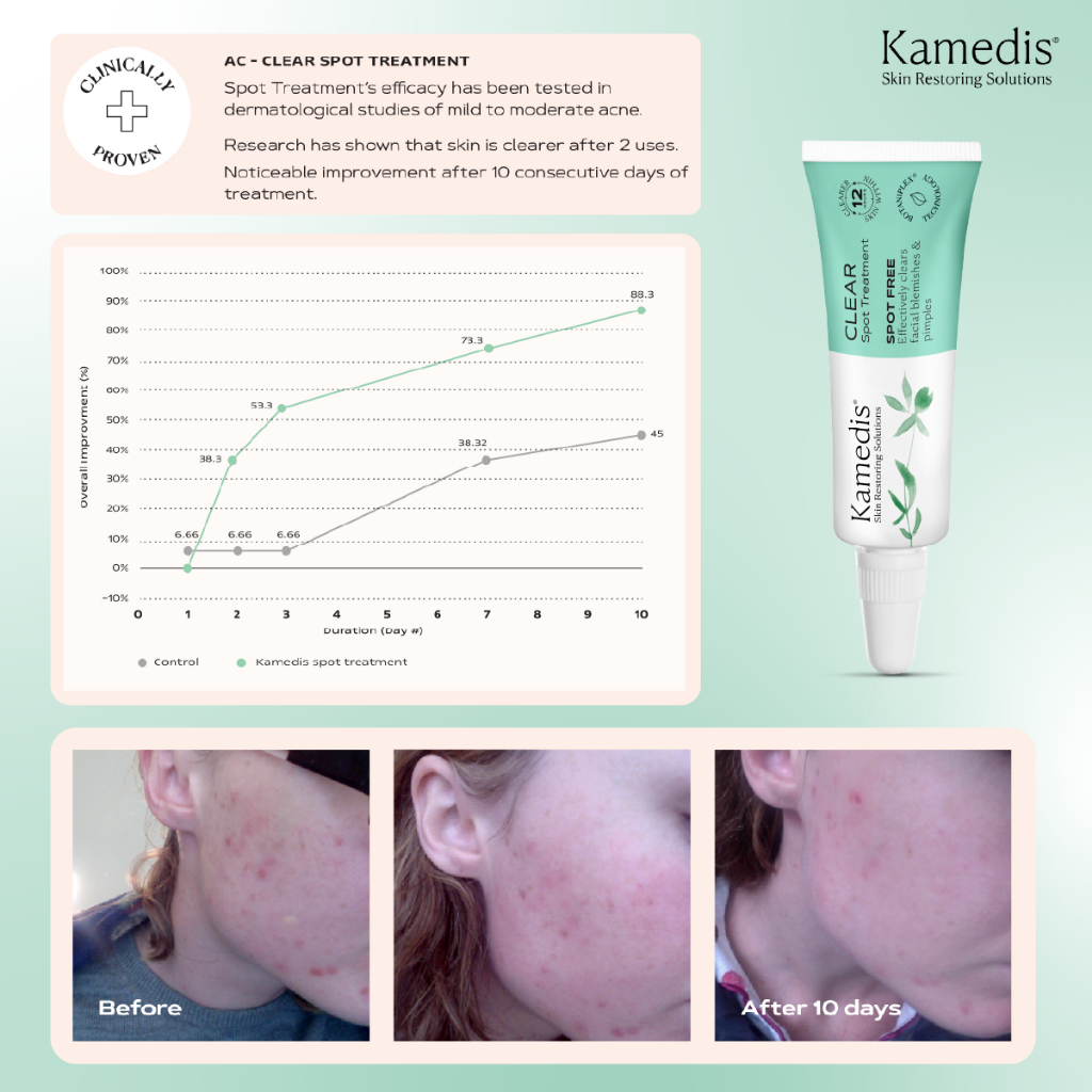 Kamedis علاج موضعي CLEAR Spot ‏22 مل — صورة 6