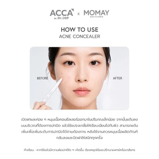 ACCA by Dr.DSP X MOMAY เทอร์พินอลแอคเน่คอนซีลเลอร์ 1.5g แอคก้าบายดร.ดีเอสพี เอ็กซ์โมเ