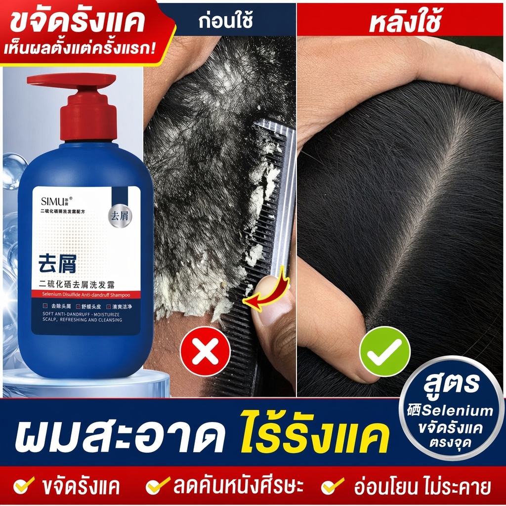 แชมพูสูตรสะอาดต่อต้านเชื้อรา 300ml ขจัดรังแคไรฝุ่น ดูแลรูขุมขน ผมนุ่มฟูสดชื่นใช้ทุกวัย