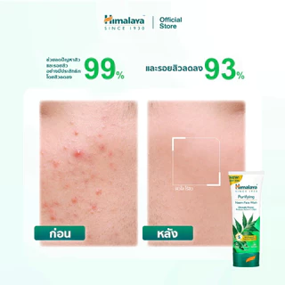 Himalaya Purifying Neem Face Wash 50ml หิมาลายา เจลล้างหน้า สูตรลดการสะสมแบคทีเรีย และควบคุมความมัน