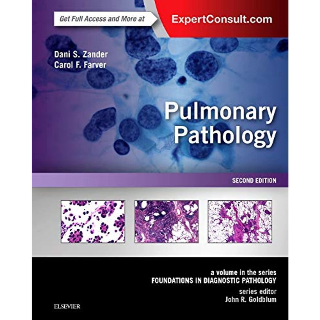 หนังสือ Pulmonary Pathology E-Book: A Volume in Foundations in Diagnostic Pathology Series ed 2/2018