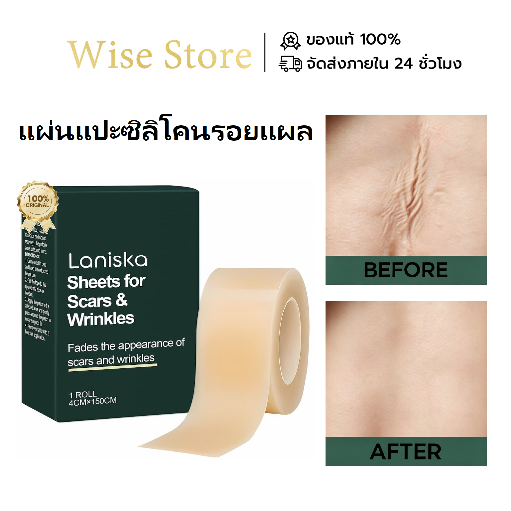 Laniska แผ่นซิลิโคนลดรอยแผลเป็นและริ้วรอย กันน้ำ ปรับขนาดได้ตามต้องการ ใช้กับแผลเป็นทุกชนิด ใช้งานง่าย 4cmx150cm
