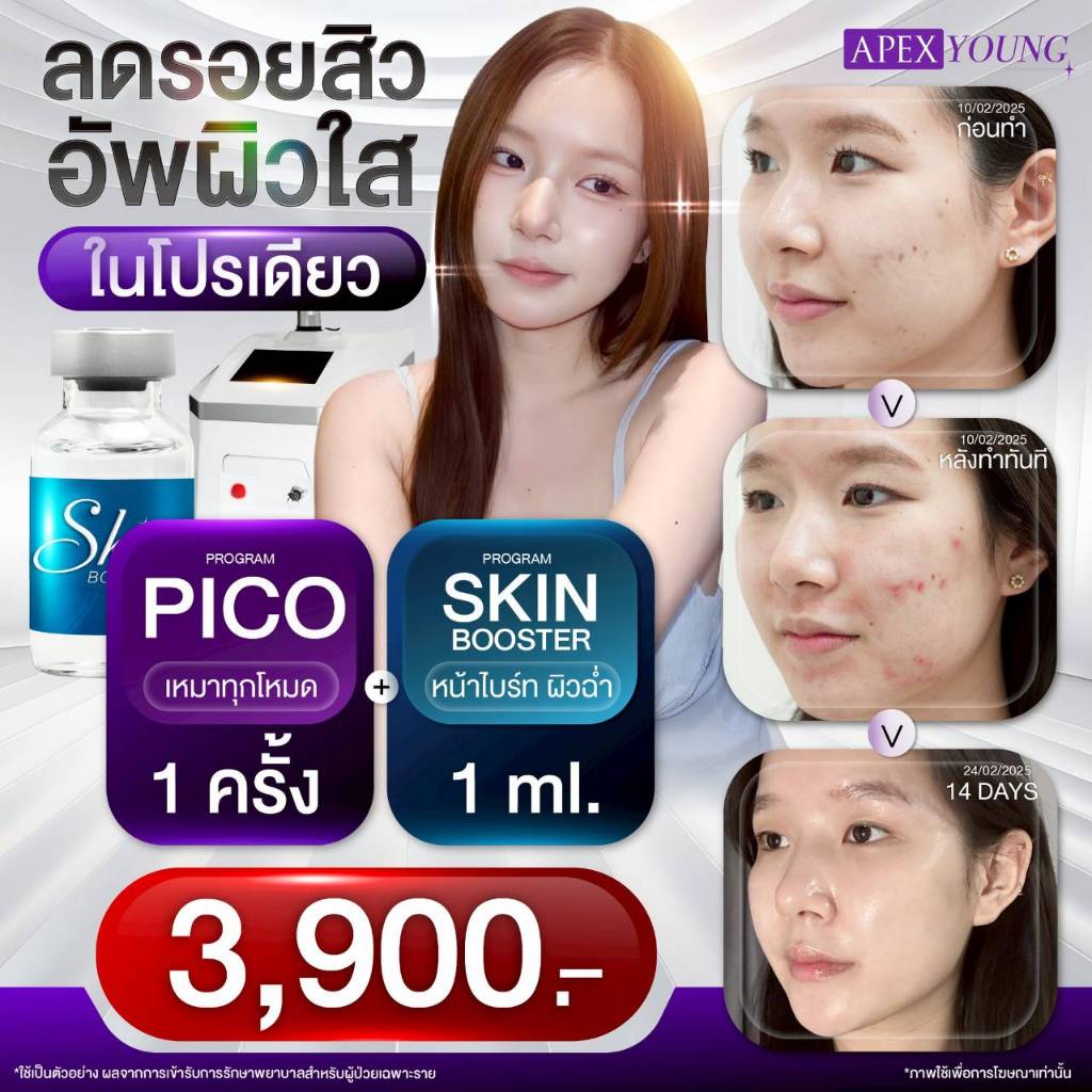 E-Voucher Apex โปรแกรม Pico All Mode + Skin Booster หลุมสิว รอยสิวหาย หน้าใส วิตามิน ขาวใสครบ 3900 เ