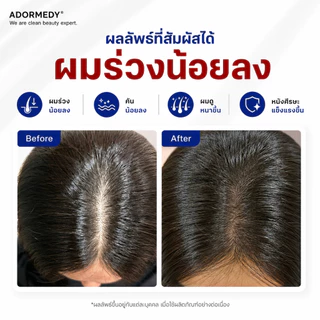 [ชุดคู่] ชาร์โคโลจี แชมพูและครีมนวดถ่านไม้ไผ่ สูตรลดผมขาดร่วง Charcoalogy Revitalizing Shampoo&Condi