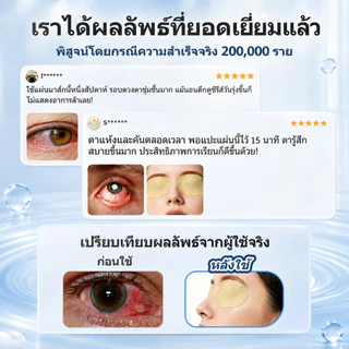 Kreain Nature แผ่นแปะตา มาส์กตา ลดตาล้า ตาแห้ง แสบตา ปวดตา จากจ้องหน้าจอ นอนดึก เล่นเกม เพิ่มความชุ่มชื้น ผ่อนคลายดวงตา