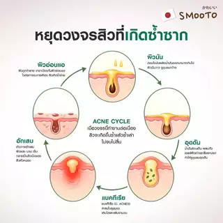 SMOOTO Official สมูทโตะ แอคเน่ แบริเออร์ ซูทติ้ง เซรั่ม (SMT200 / กล่อง)