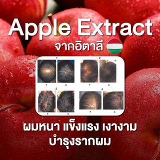 NUCERA H [นูเซร่า เอช] วิตามินลดผมร่วง กู้ผมสวย เพิ่มผมหนา และเร่งสร้างผมใหม่ลึกถึงรากผม