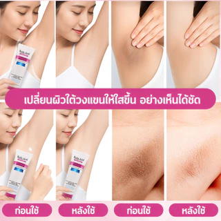 Kojic Acid ครีมบำรุงผิว 50ml ทารักแร้ ขาหนีบ เข่า คอดำ ปรับผิวให้ขาวกระจ่างใส