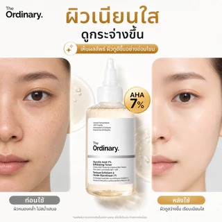 The Ordinary Glycolic Acid 7% โทนเนอร์ ลดรอยสิว คลายเซลล์ผิวเก่า ผิวดูเนียนขึ้น