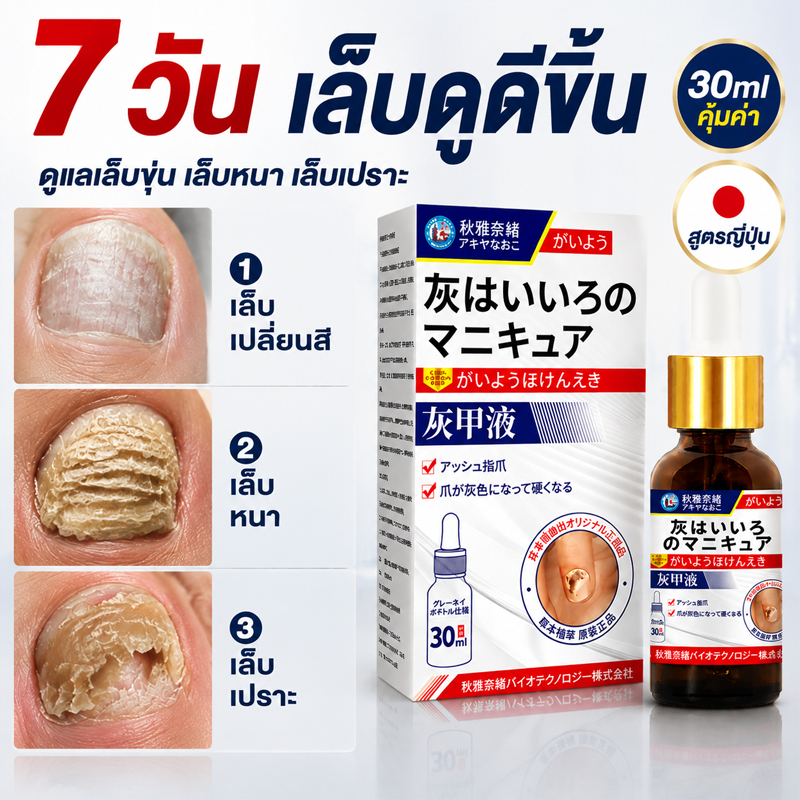 บำรุงเล็บ กำจัดเชื้อราเล็บ เซรั่มบำรุงเล็บ น้ำยารักษาเชื้อราที่เล็บ น้ำยาซ่อมแซมเล็บเหลือง น้ำยารักษาเล็บ nail repair