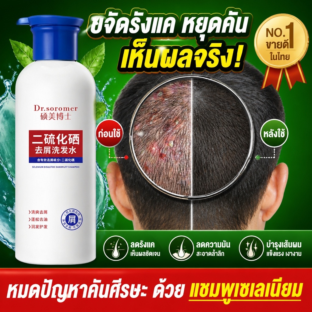 แชมพูซีลีเนียมไดซัลไฟด์ ขนาด400ml ขจัดรังแค ดูแลหนังศีรษะ ผมนุ่มฟูสดชื่น