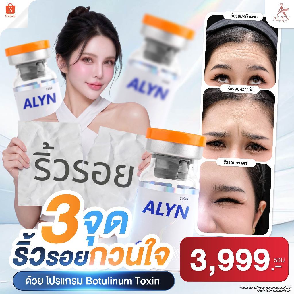 โปรแกรม Botulinum Toxin ฉีดโบท็อกซ์ลดริ้วรอย 3 จุดกวนใจ (50 Unit) | ALYN Clinic