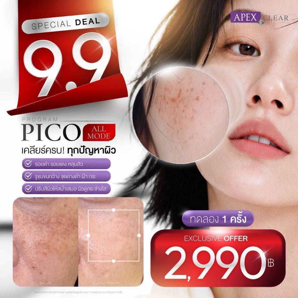 9.9 [E-Voucher] APEX Pico New Gen All Mode ลดรอยสิว หลุมสิวตื้น ทดลอง 2990 /ครั้ง (1ท่าน1สิทธิ์)