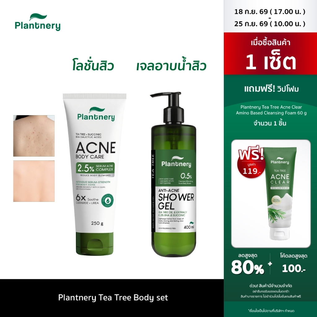 Plantnery Tea Tree  Body set  Tea Tree Succinic Acid Body Lotion 250g and  Tea Tree Succinic Acne Shower Gel 400ml