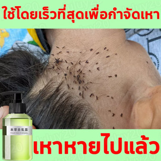 ยาฆ่าเหา 100ml กำจัดถึงต้นตอ สารสกัดจากธรรมชาติ ปลอดภัยไม่ระคายเคือง แชม แชมพูเหา แชมพูกำจัดเหา แชมพูฆ่าเหา แชมพูขจัดเหา