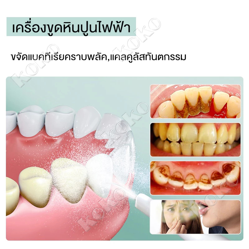เครื่องขูดหินปูน 40000ครั้ง/นาที เครื่องทำความสะอาดฟันไฟฟ้าระบบอัลตราโซนิก เครื่องขัดฟัน เครื่องขูดหินปูนไฟฟ้า