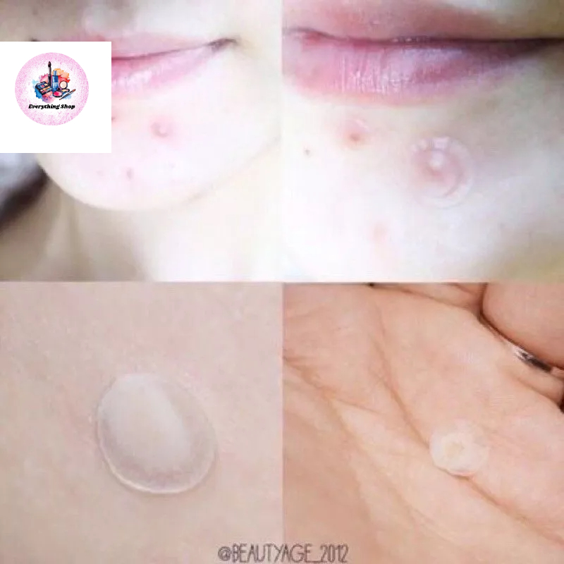 (แท้/พร้อมส่ง)แผ่นแปะสิว แผ่นดูดสิว Olive Young Care Plus Spot Patch - รูปที่ 5