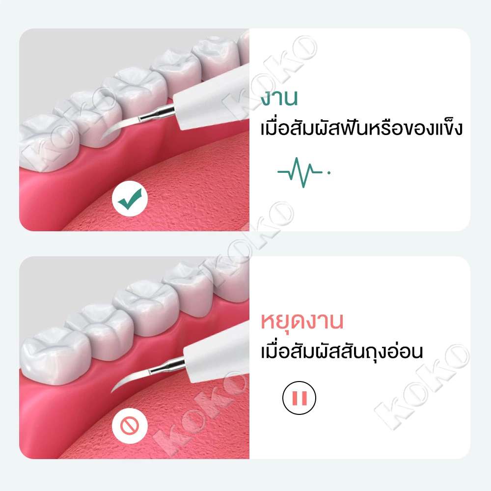 เครื่องขูดหินปูน 40000ครั้ง/นาที เครื่องทำความสะอาดฟันไฟฟ้าระบบอัลตราโซนิก เครื่องขัดฟัน เครื่องขูดหินปูนไฟฟ้า