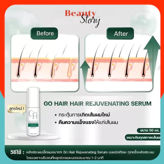 สูตรใหม่👷 Go Hair Rejuvenating 50ml (Neo Serum เดิม) ลดผมร่วง เร่งผมยาว โกแฮร์ นีโอ เซรั่ม บำรุงผม (กล่อง แบบใหม่)