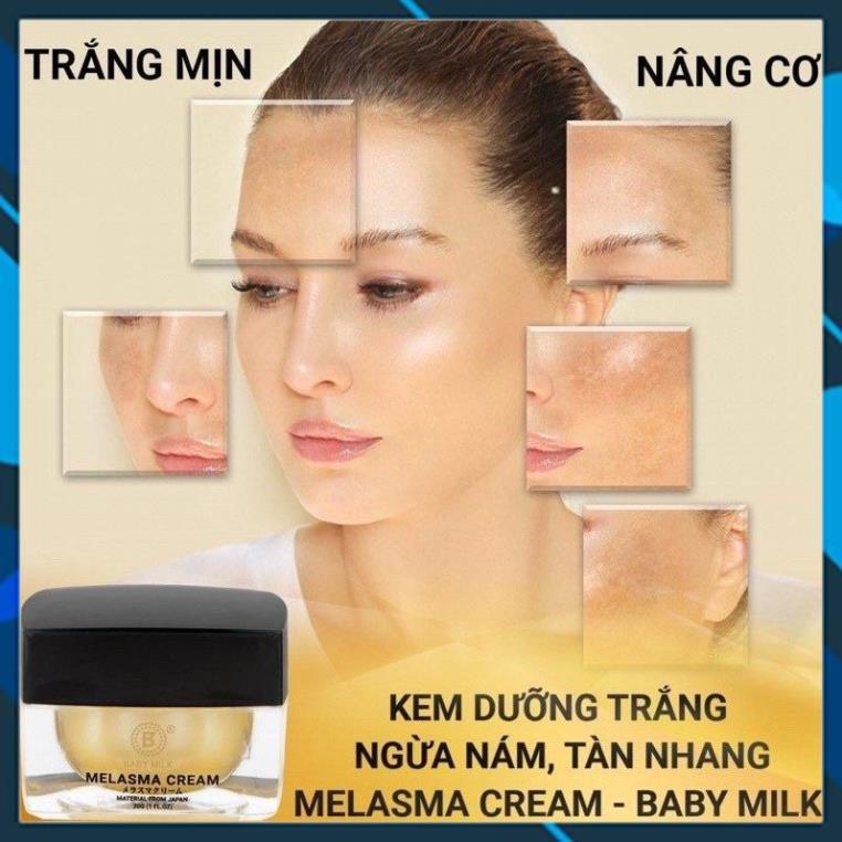[Hot ] ครีมฝ ้ า Baby Milk Freckles Whitening Lift Cream 30g - แบรนด ์ Thien Nhi