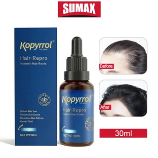 Sumax 5% Mnioixdil anti-hairloss serum เซรั่มบำรุงผม ลดผมร่วง